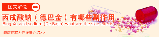 丙戍酸钠片有副作用吗