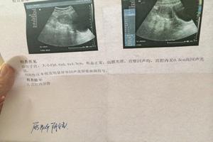 晋江引产多久来月经(引产要多久来月经)