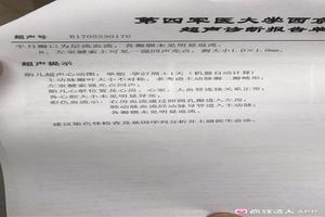 晋江中孕引产(中孕引产是什么)