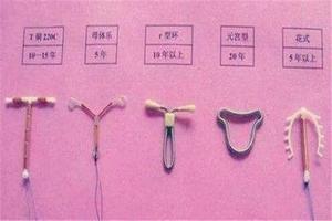 晋江上环后月经量多(上环后月经量多好还是少好)