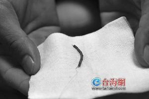 晋江上环痛不痛(上环痛不痛吗)