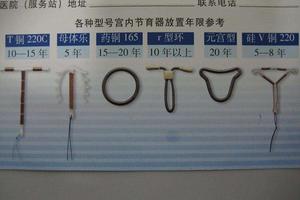 晋江上环什么环最好(泉州上环哪家医院好)