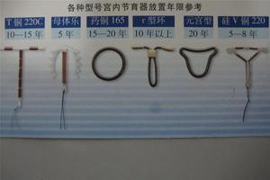 晋江一般上环多少钱(上环收费标准)
