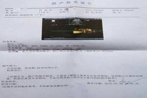 晋江引产检查前(引产前做检查多少钱)