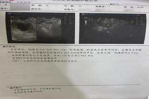 晋江上环后痛经(上环痛经正常吗)