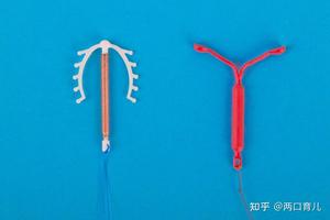 晋江上环移位(安环移位的可能性大吗)