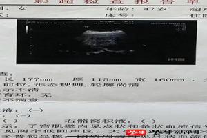 晋江怀孕六个月可以引产吗(孕六个月能引产吗)