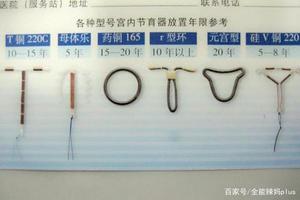 晋江上环会掉吗(上环会不会掉了)