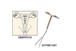 晋江上环几天后可以同环(上环几日后能同房)
