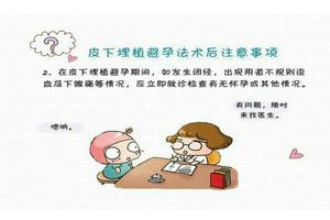 晋江上环好还是皮下埋植好(是上环好还是皮埋好)