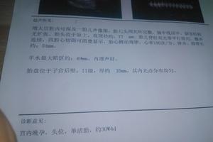 晋江14周做引产(14周引产住院要带什么东西)