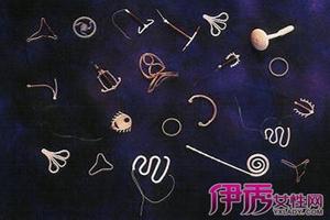 晋江上环要开刀吗(上环要去手术室吗)
