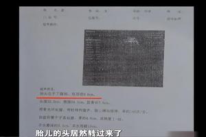 晋江4个月引产疼吗(四个月了引产疼吗)