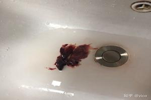 晋江药流多久不流血(药流多长时间就不流血了)
