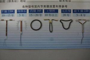 晋江上环要多久才能同环(一般上环多长时间适应)