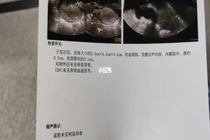 晋江引产多久复查(引产多久复查最合适)