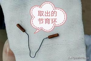 晋江为什么上环(晋江上环免环吗)