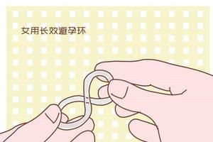 晋江上环什么原环(泉州上环多少钱)