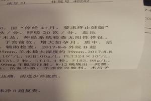 晋江引产时间(引产手术时间)