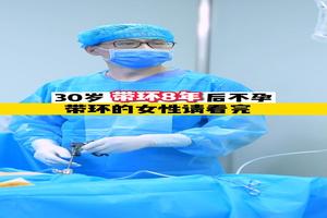 晋江上环环取环(上环取环哪家医院好)