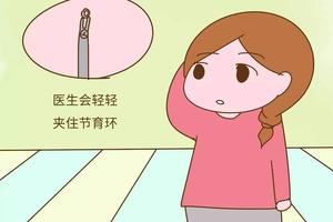 晋江二胎取环(晋江二胎取环多少钱)