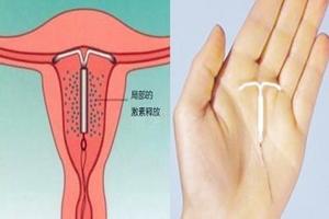 晋江什么叫上环(上环是啥意思)