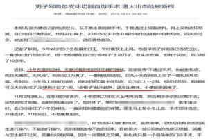 晋江上环包皮术(包皮环手术大概多少钱)
