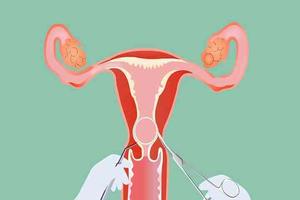 晋江取环后多久可以运动(取环之后多久能运动) 晋江取环后多久可以运动(取环之后多久能运动)