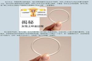 晋江上环上哪种环最好(泉州上环多少钱)