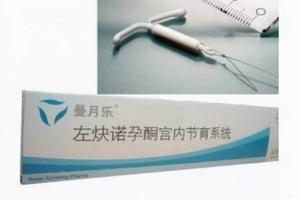 晋江上环需要多少时间(常熟上环多少钱)